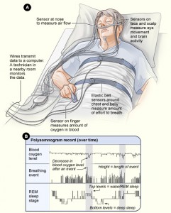 Sleep_studies